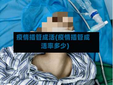 疫情插管成活(疫情插管成活率多少)