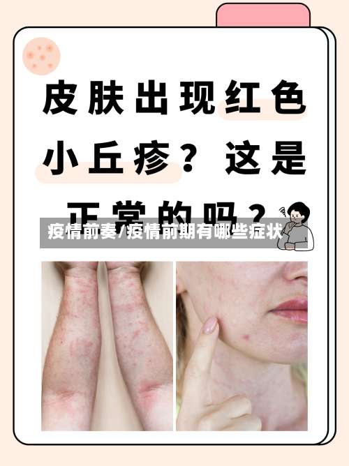 疫情前奏/疫情前期有哪些症状