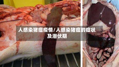 人感染猪瘟疫情/人感染猪瘟的症状及潜伏期
