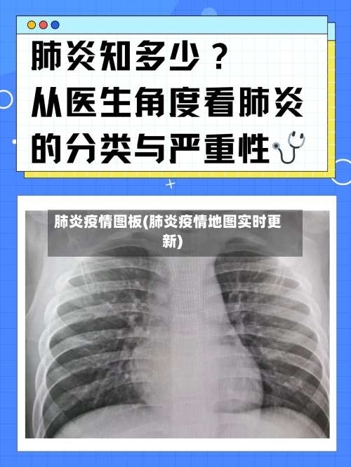 肺炎疫情图板(肺炎疫情地图实时更新)