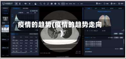 疫情的趋势(疫情的趋势走向)