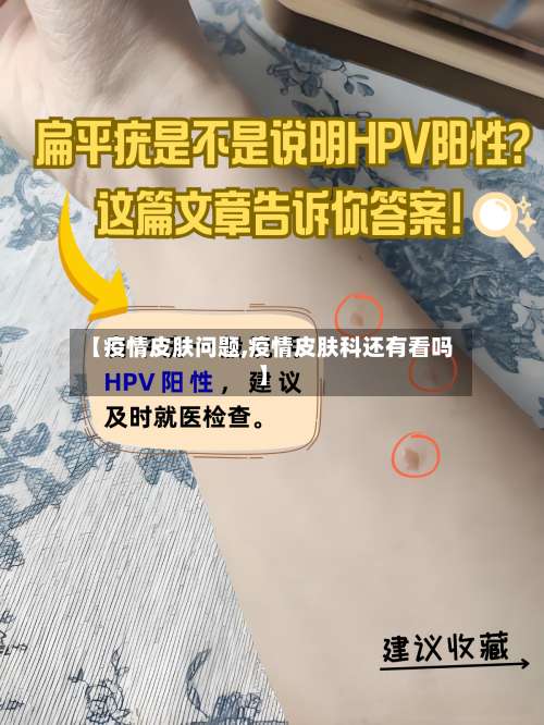 【疫情皮肤问题,疫情皮肤科还有看吗】-第2张图片