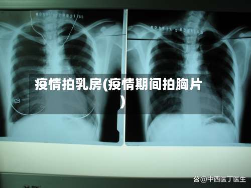 疫情拍乳房(疫情期间拍胸片)-第2张图片