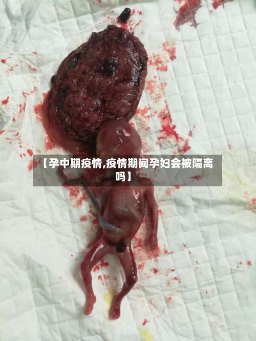【孕中期疫情,疫情期间孕妇会被隔离吗】