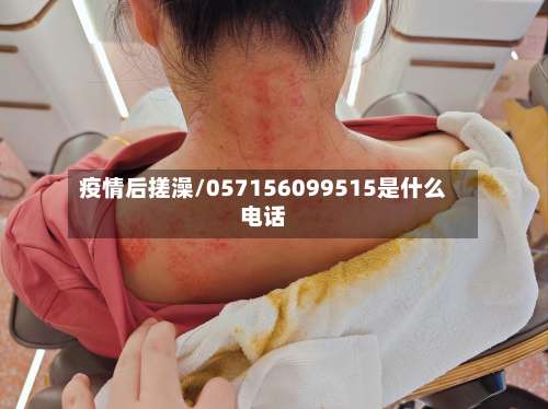 疫情后搓澡/057156099515是什么电话