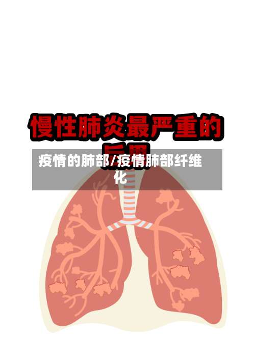 疫情的肺部/疫情肺部纤维化
