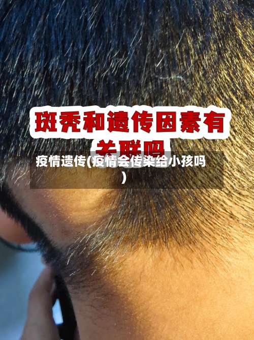 疫情遗传(疫情会传染给小孩吗)-第2张图片