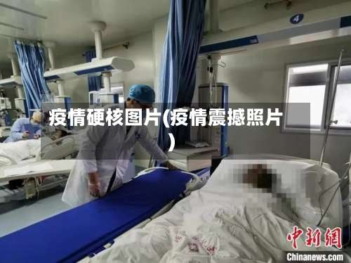疫情硬核图片(疫情震撼照片)-第2张图片